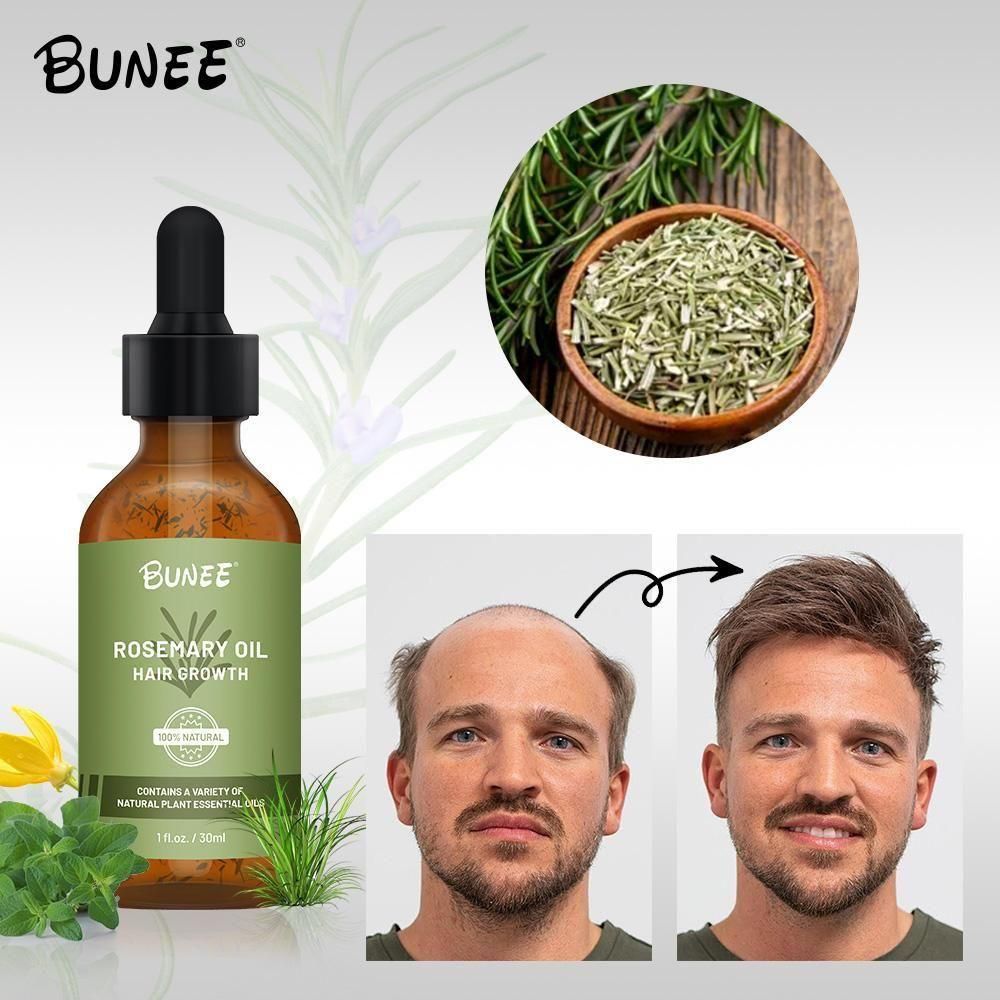 BUNEE Rosemary Hair Growth Serum Oil – Pack of 2