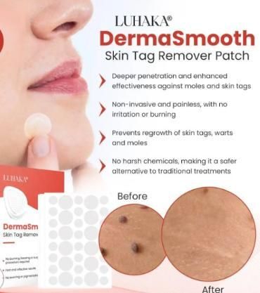 Cura Skin Tag Remover Patch โ Safe, Fast & Painless