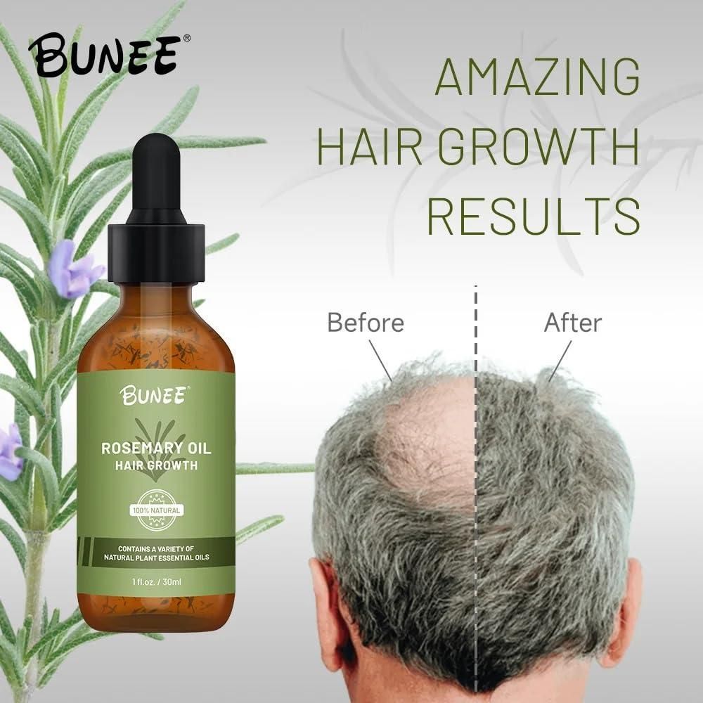 BUNEE Rosemary Hair Growth Serum Oil – Pack of 2