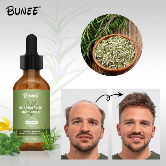 BUNEE Rosemary Hair Growth Serum Oil – Pack of 2